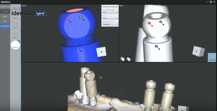 Medit-identica hybrid 3D 掃描器 定位桿